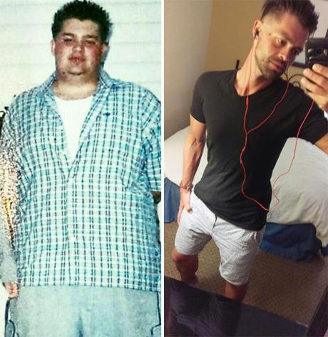 Casos de personas antes y después de perder peso tan...