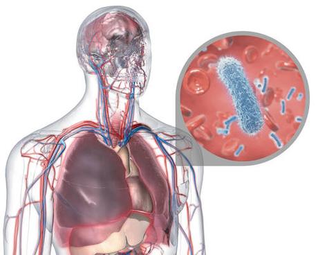 Un Manejo Agresivo de la Sepsis no Aporta Ningun Beneficio