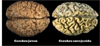 ¿La sangre joven podría mejorar el cerebro envejecido?