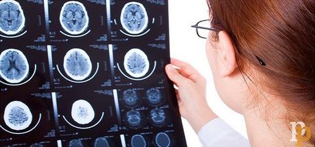 ¿Qué es la neuropsicología?