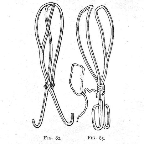 con fórceps bbc mundo