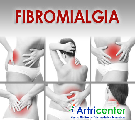 ¿Sabías que hay 4 tipos de fibromialgia?