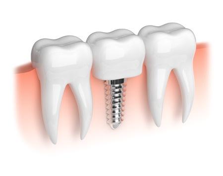 clínica dental Málaga