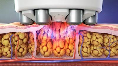 Quieres saber el truco para lucir perfecta en los eventos...?! Quieres saber el truco para lucir perfecta en los eventos...?!