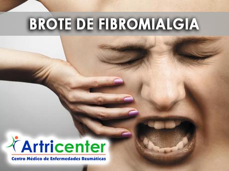 Cómo actuar ante un brote de fibromialgia Cómo actuar ante un brote de fibromialgia