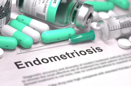Tratamiento para la endometriosis con terapias quirúrgicas, medicamentos y remedios naturales para la endometriosis Tratamiento para la endometriosis con terapias quirúrgicas, medicamentos y remedios naturales para la endometriosis