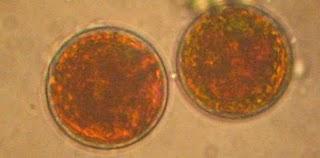 Un estudio realizado por expertos andaluces refuerza las posibilidades dietéticas de las microalgas Un estudio realizado por expertos andaluces refuerza las posibilidades dietéticas de las microalgas