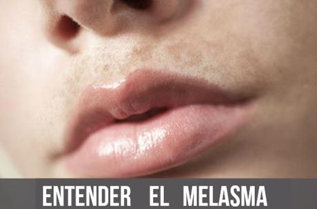 PROCESO DE FORMACIÓN DE MELANINA PROCESO DE FORMACIÓN DE MELANINA