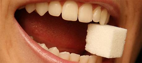 ¿Por qué es malo comer azúcar? El azúcar es la principal causa de la caries