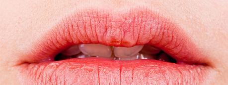 Consejos de hidratación para labios secos