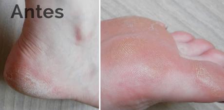Peeling quimico pies Tonymoly Shiny Foot Peeling pies antes después