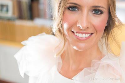 Blanqueamiento dental antes de la boda Blanqueamiento dental antes de la boda