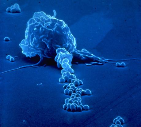 Sistema Inmune (I) Sistema Inmune (I)