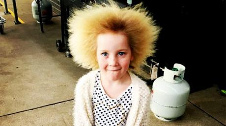 Niña sufre de un extraño síndrome donde su cabello es imposible peinarlo