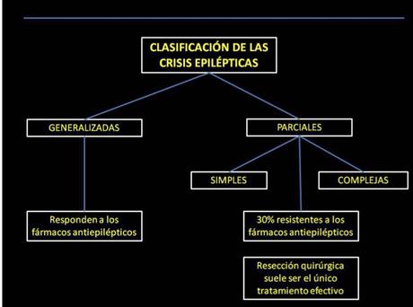 Clasificación de epilepsias