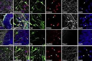 Retrasar el reloj celular para estudiar el Parkinson Retrasar el reloj celular para estudiar el Parkinson