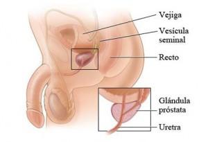la próstata Problemas de prostata