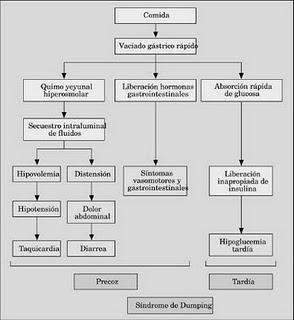 ¿Qué es...?: El síndrome de Dumping