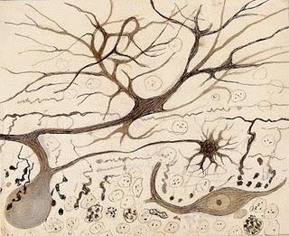 La enfermedad de Alzheimer se asocia a variantes comunes de ciertos genes. La enfermedad de Alzheimer se asocia a variantes comunes de ciertos genes.
