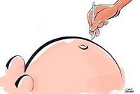 Mexico: Nacimientos por cesárea, una práctica en abuso Mexico: Nacimientos por cesárea, una práctica en abuso