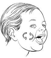 Estimulación perioral Estimulación perioral