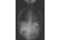 Dos urgencias frecuentes ¿cuál es su diagnóstico? Dos urgencias frecuentes ¿cuál es su diagnóstico?