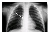Dos urgencias frecuentes ¿cuál es su diagnóstico? Dos urgencias frecuentes ¿cuál es su diagnóstico?