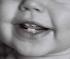 dientes ¿Cuando aparecen los dientes de leche?