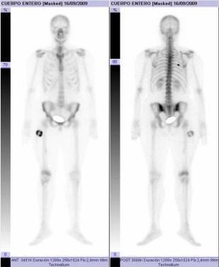 Herramientas moleculares para el Diagnóstico Herramientas moleculares para el Diagnóstico