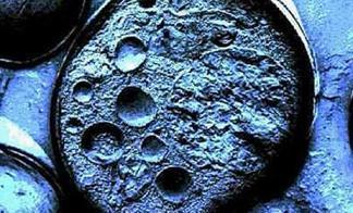 Tratamiento para la artrosis con celulas madre Tratamiento para la artrosis con celulas madre