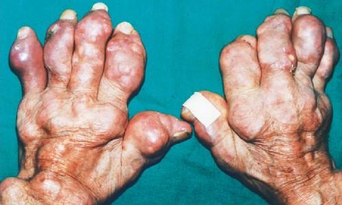 Jugá a ser House, caso #3 foto dx3 Jugá a ser House, caso #3