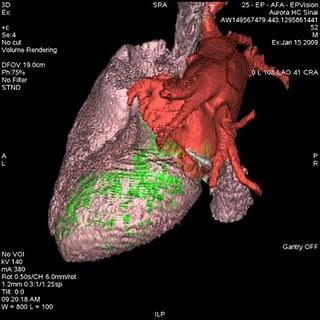 El conjunto de dispositivos integrados de EF de GE Healthcare da valor añadido en las decisiones críticas orientadas al paciente El conjunto de dispositivos integrados de EF de GE Healthcare da valor añadido en las decisiones críticas orientadas al paciente