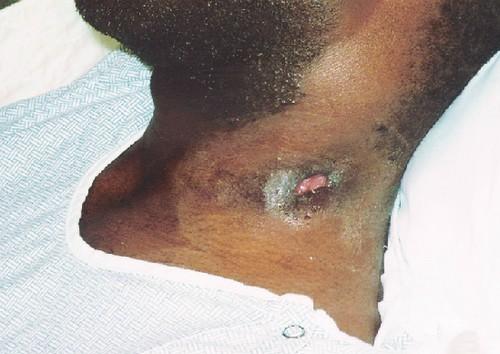 Jugá a ser House Caso #7 foto dx7 Jugá a ser House Caso #7