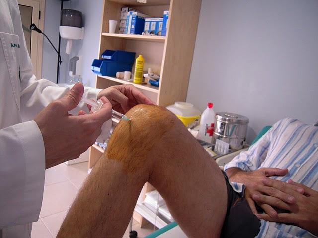 Segunda y última infiltración de ácido hialurónico.... Rien ne va plus..!! Segunda y última infiltración de ácido hialurónico.... Rien ne va plus..!!