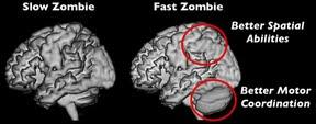 ¿Qué le pasa a un zombie por la cabeza?