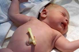 cordonumbilical Cuándo cae el cordón umbilical y cuidados del cordón umbilical del bebé
