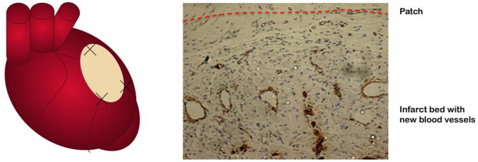 Un andamio biologico para permitir que el tejido cardiaco se repare a si mismo Un andamio biologico para permitir que el tejido cardiaco se repare a si mismo