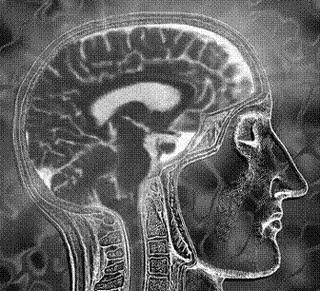 La Física podría ayudar a curar la EA La Física podría ayudar a curar la EA