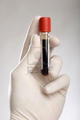 Reclaman pruebas 'más sensibles' para sangre