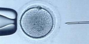 Fecundación in Vitro Fecundación in Vitro