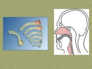 Respuesta a un caso particular de negligencia (10) Respuesta a un caso particular de negligencia (10)