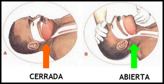 Respuesta a un caso particular de negligencia (10) Respuesta a un caso particular de negligencia (10)