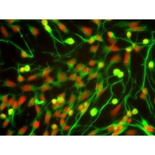Tipos de Microscopios ópticos Tipos de Microscopios ópticos