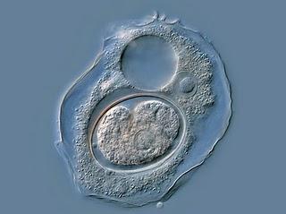 Tipos de Microscopios ópticos Tipos de Microscopios ópticos