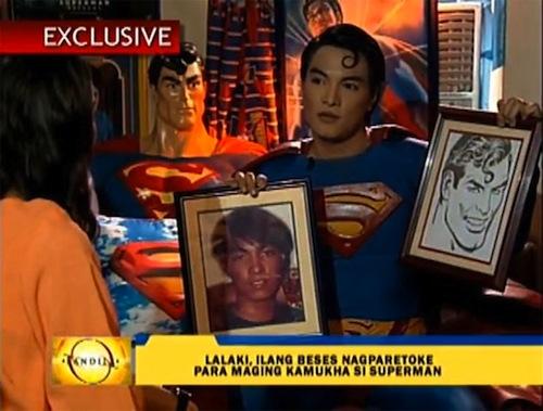 Filipino desea convertirse en Superman a punta de cirugías