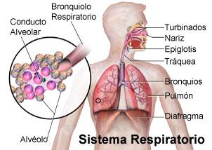 Enfermedades pulmonares: neumonía