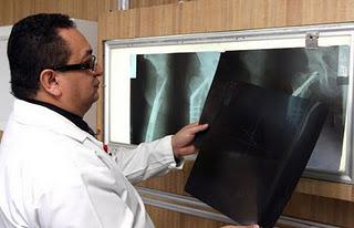 Sedentarismo, desnutrición, tabaco y alcohol aceleran la aparición de osteoporosis: IMSS Sedentarismo, desnutrición, tabaco y alcohol aceleran la aparición de osteoporosis: IMSS