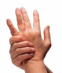 artristispsoriasis Programas para combatir la artritis psoriásica