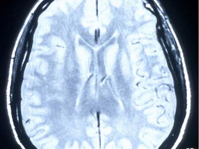 Canal Historia: El Cerebro l y ll Canal Historia: El Cerebro l y ll