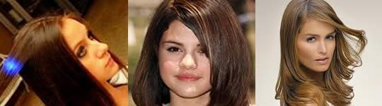 hidrocauterizacion molecular hidrocauterizacion molecular